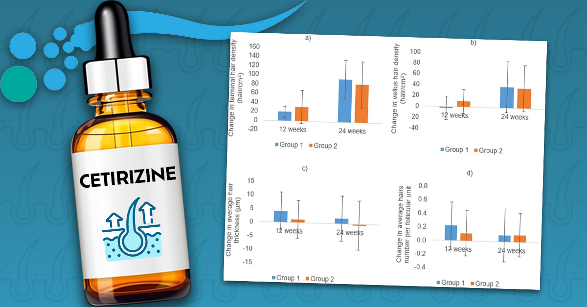 Cetirazine Rash Topical Cetirizine: The Complete Guide - Follicle Thought